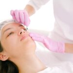OPATRA LONDON in Zürich – RF Microneedling